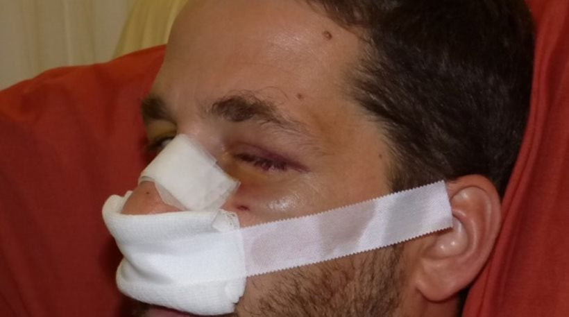 Στο «σκαμνί» οι νατοϊκοί στρατιώτες για τον άγριο ξυλοδαρμό Χανιώτη -Στο νοσοκομείο με σοβαρά τραύματα το θύμα
